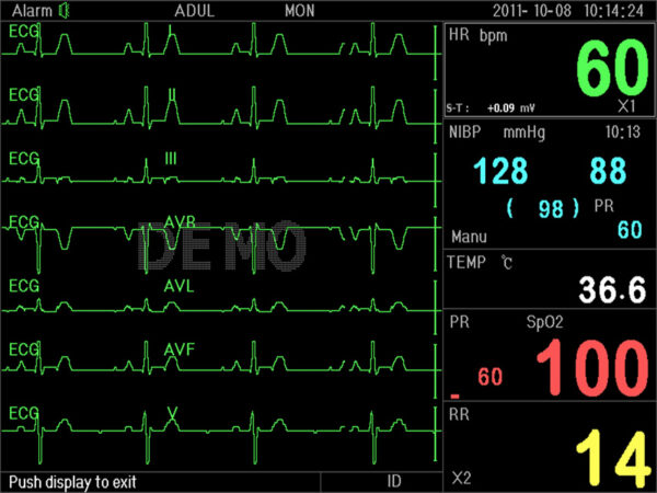 MONITOR MULTIPARAMETRICO PARAMETRI VITALI - immagine 3